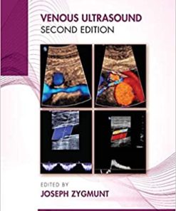 Venous Ultrasound, 2ed (PDF)