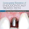 Contemporary Restoration of Endodontically Treated Teeth: Evidence-Based Diagnosis and Treatment Planning (PDF) Contemporary Restoration of Endodontically Treated Teeth: Evidence-Based Diagnosis and Treatment Planning (PDF)