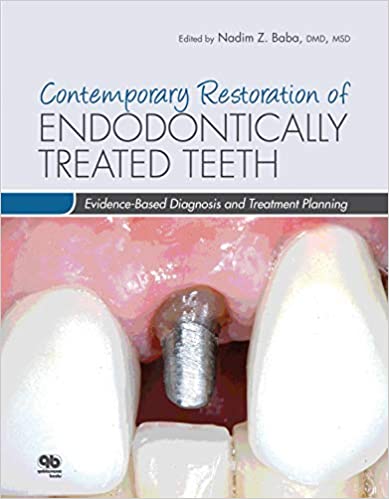 Contemporary Restoration of Endodontically Treated Teeth: Evidence-Based Diagnosis and Treatment Planning (PDF) Contemporary Restoration of Endodontically Treated Teeth: Evidence-Based Diagnosis and Treatment Planning (PDF)