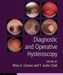 Diagnostic and Operative Hysteroscopy (PDF Book + Videos)