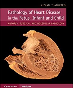 Pathology of Heart Disease in the Fetus, Infant and Child (PDF)