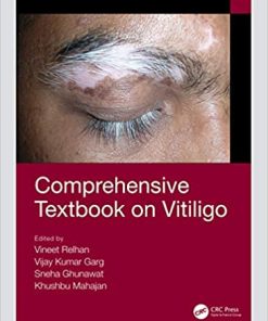 Comprehensive Textbook on Vitiligo (PDF)