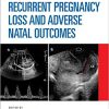 Recurrent Pregnancy Loss and Adverse Natal Outcomes