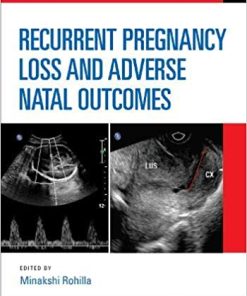 Recurrent Pregnancy Loss and Adverse Natal Outcomes