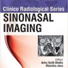 Sinonasal Imaging (Clinico Radiological Series) (PDF) Sinonasal Imaging (Clinico Radiological Series) (PDF)