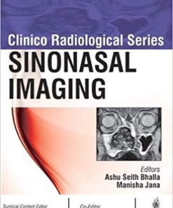 Sinonasal Imaging (Clinico Radiological Series) (PDF)