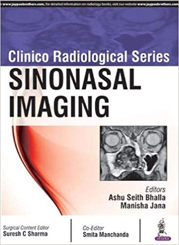 Sinonasal Imaging (Clinico Radiological Series) (PDF) Sinonasal Imaging (Clinico Radiological Series) (PDF)