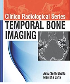 Clinico Radiological Series: Temporal Bone Imaging (PDF)