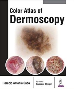 Color Atlas of Dermoscopy (PDF)