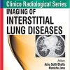 Imaging of Interstitial Lung Diseases (Clinico Radiological) (PDF)