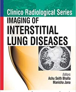 Imaging of Interstitial Lung Diseases (Clinico Radiological) (PDF)