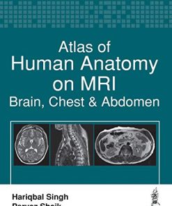 Atlas of Human Anatomy on MRI: Brain, Chest and Abdomen (PDF)