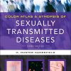 Color Atlas & Synopsis of Sexually Transmitted Diseases, Third Edition (PDF)