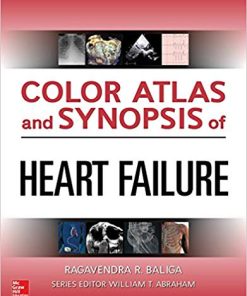 Color Atlas and Synopsis of Heart Failure (PDF)