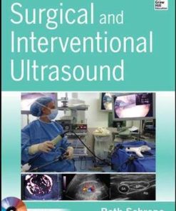 Surgical and Interventional Ultrasound (Videos)