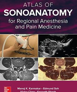 Atlas of Sonoanatomy for Regional Anesthesia and Pain Medicine (PDF)