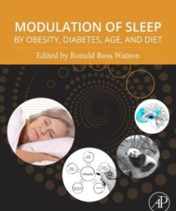 Modulation of Sleep by Obesity, Diabetes, Age, and Diet (PDF)