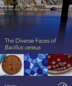 The Diverse Faces of Bacillus Cereus