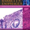 Barrett’s Esophagus: Emerging Evidence for Improved Clinical Practice