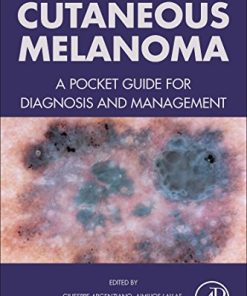 Cutaneous Melanoma: A Pocket Guide for Diagnosis and Management (EPUB)