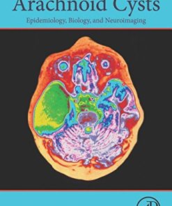 Arachnoid Cysts: Epidemiology, Biology, and Neuroimaging (EPUB)