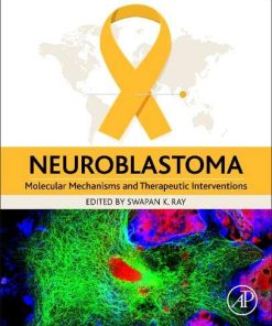 Neuroblastoma: Molecular Mechanisms and Therapeutic Interventions