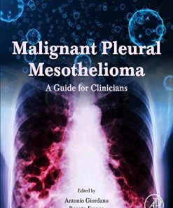 Malignant Pleural Mesothelioma: A Guide for Clinicians (PDF)