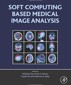 Soft Computing Based Medical Image Analysis (EPUB)