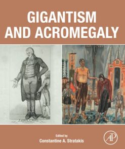 Gigantism and Acromegaly: Genetics, Diagnosis, and Treatment (PDF)