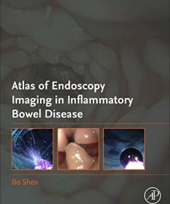 Atlas of Endoscopy Imaging in Inflammatory Bowel Disease (PDF)