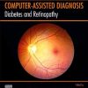 Diabetes and Retinopathy (PDF)