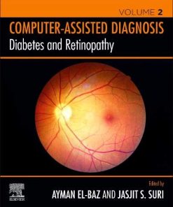 Diabetes and Retinopathy (PDF)