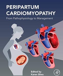 Peripartum Cardiomyopathy: From Pathophysiology to Management (PDF)