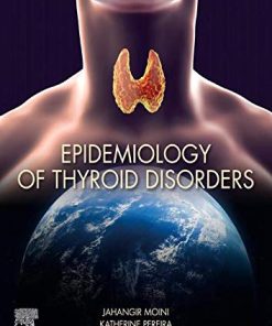 Epidemiology of Thyroid Disorders (PDF)