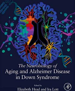 The Neurobiology of Aging and Alzheimer Disease in Down Syndrome (PDF)