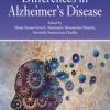 Sex and Gender Differences in Alzheimer’s Disease (PDF)