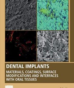 Dental Implants: Materials, Coatings, Surface Modifications and Interfaces with Oral Tissues (Woodhead Publishing Series in Biomaterials) (PDF)