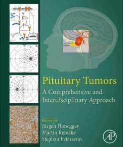 Pituitary Tumors: A Comprehensive and Interdisciplinary Approach (PDF)