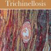 Trichinella and Trichinellosis (PDF)