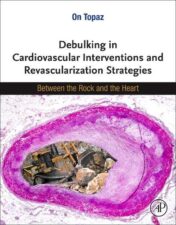 Debulking in Cardiovascular Interventions and Revascularization Strategies: Between a Rock and the Heart 2022 Original PDF
