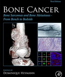 Bone Cancer: Bone Sarcomas and Bone Metastases – From Bench to Bedside, 3rd Edition (PDF)