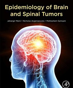 Epidemiology of Brain and Spinal Tumors (PDF)