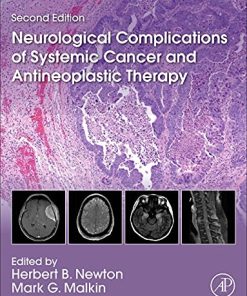 Neurological Complications of Systemic Cancer and Antineoplastic Therapy (PDF)