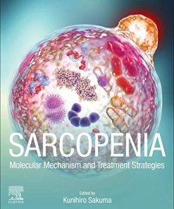 Sarcopenia: Molecular Mechanism and Treatment Strategies (PDF)