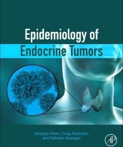 Epidemiology of Endocrine Tumors (PDF)