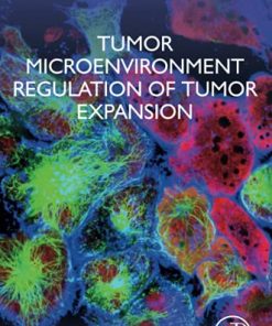 Tumor Microenvironment Regulation of Tumor Expansion (PDF)