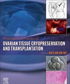 Principles and Practice of Ovarian Tissue Cryopreservation and Transplantation (PDF)