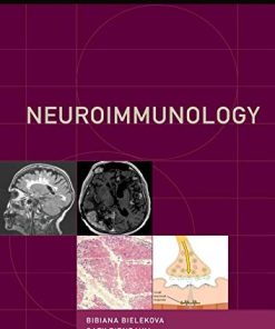 Neuroimmunology (Contemporary Neurology Series) (PDF)