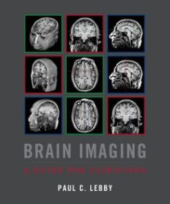 Brain Imaging: A Guide for Clinicians