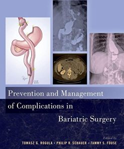 Prevention and Management of Complications in Bariatric Surgery (PDF)